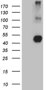 NEGR1 / Neurotractin Antibody (aa80-205, clone OTI3G8)