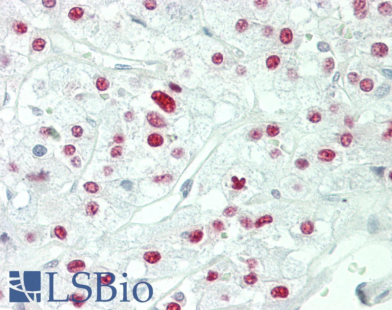 IHC-plus™ Monoclonal Rabbit anti-Human CRTC1 / MECT1 / TORC1 Antibody (IHC, WB)