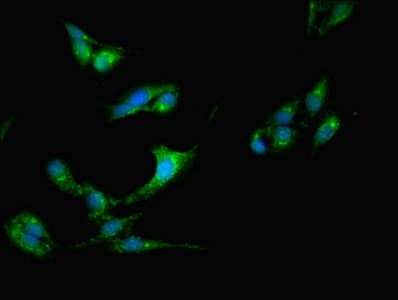CSDE1 Antibody