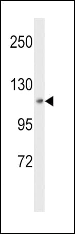 MAP4K3 / GLK Antibody (aa31-283)