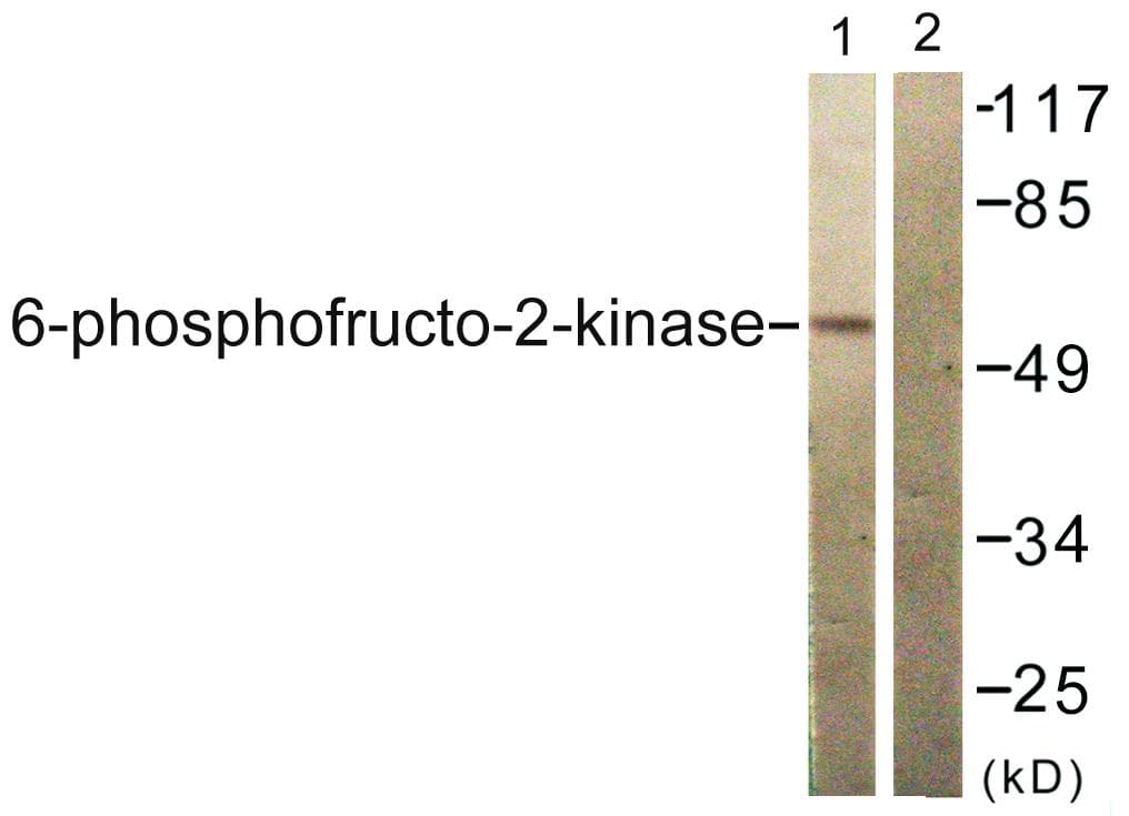 PFKFB2 Antibody (p483)
