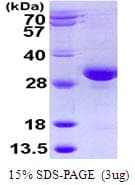 Human RAB32 Protein (Recombinant His)