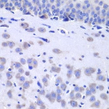 HTT / Huntingtin Antibody