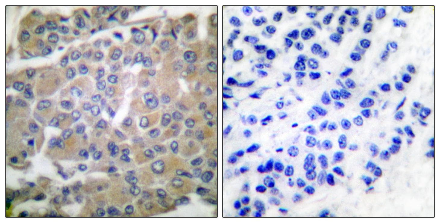 MMP8 Antibody