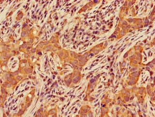 Ceramide Kinase / CERK Antibody