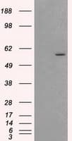 AKT2 Antibody (clone OTI1A2)