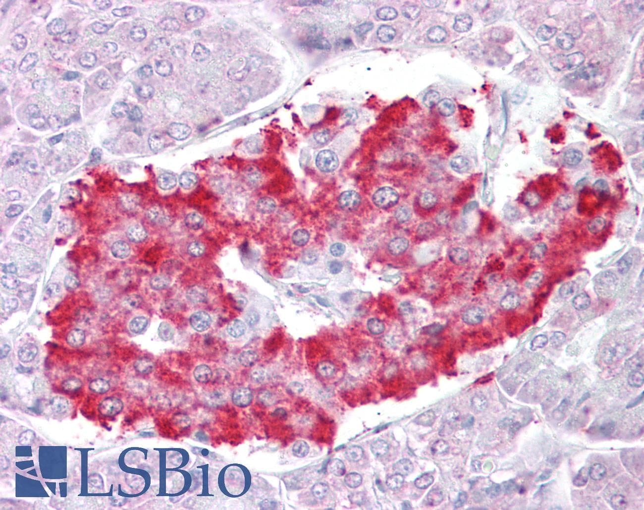 IHC-plus™ ATG4D Antibody (aa444-457)