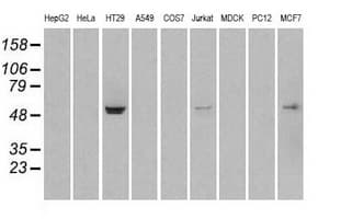 STK39 / SPAK Antibody (clone OTI4H3)