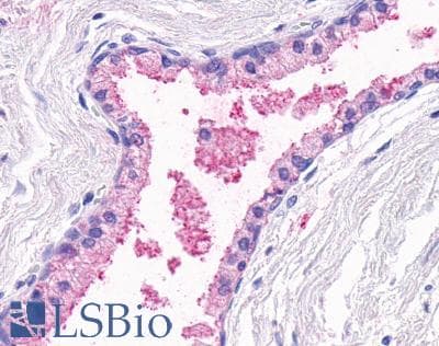 PathPlus™ Polyclonal Rabbit anti-Human OR51E1 Antibody (Cytoplasmic Domain, IHC)