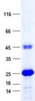 Human ZNF268 Protein (Recombinant His, N-Terminal)