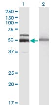 HEXA Antibody (clone 3D1)