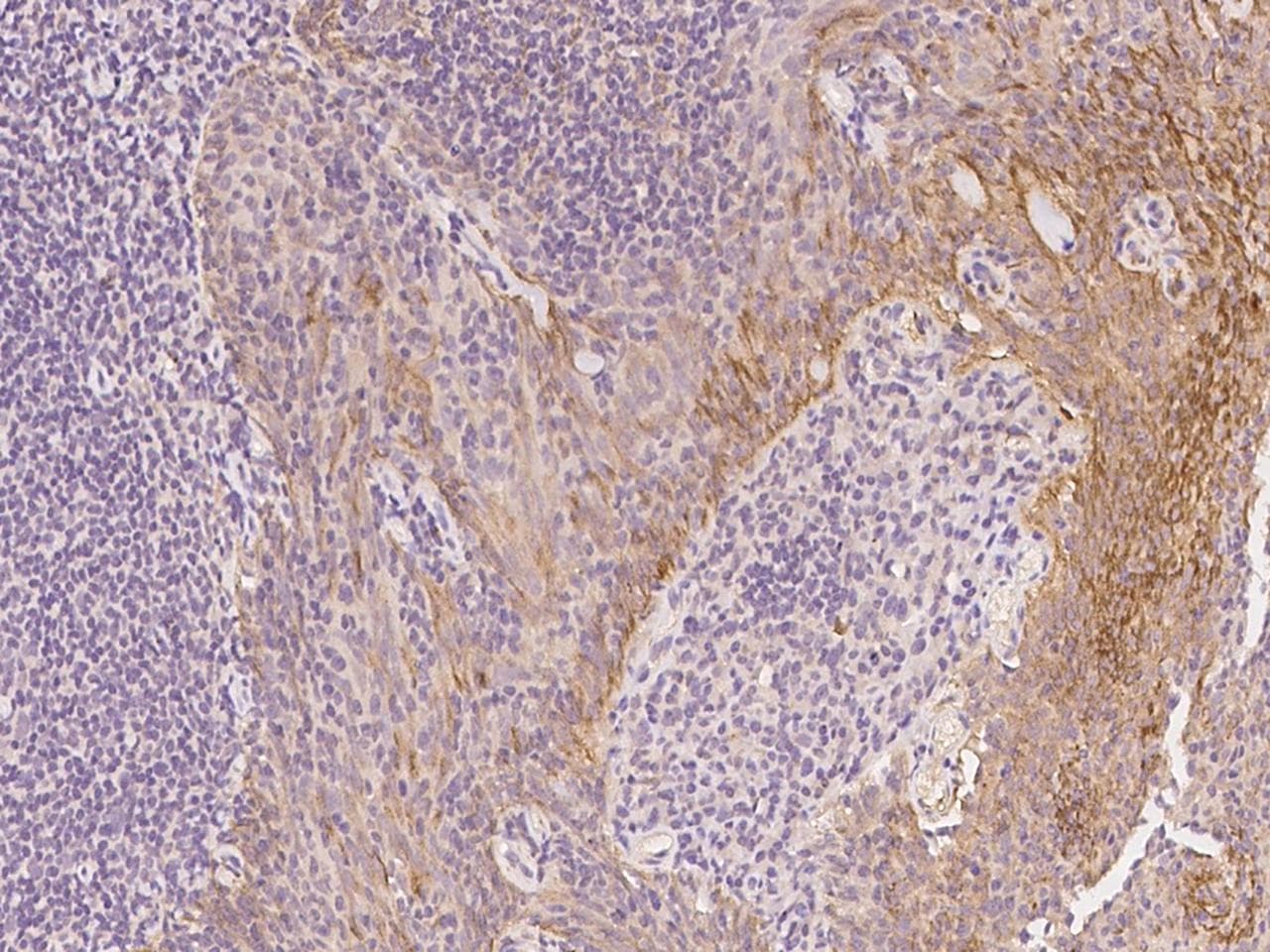 COL5A3 / Collagen V Alpha 3 Antibody