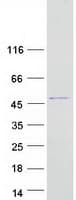 Human RABEPK / p40 Protein (Recombinant Myc-DDK (Flag))