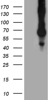 Monoclonal Mouse anti-Human CD68 Antibody (clone OTI2E2, aa22-319, IHC, WB)