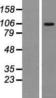 MTBP / Mdm2-Binding Protein (Over-Expression Lysate Myc-DDK (Flag))