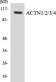 ACTN1+2+3+4 Antibody (aa48-97)