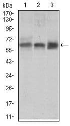 Monoclonal Mouse anti-Human ALK3 / BMPR1A Antibody (clone 4B7B2, Amino Acid: 179-378, IHC, WB)