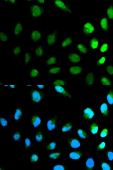 NEDD8 Antibody
