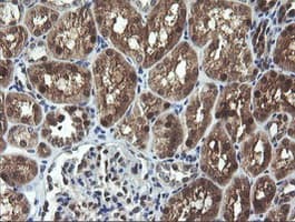 CMPK / CMPK1 Antibody (clone OTI1H8)