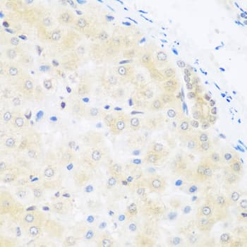 Polyclonal Rabbit anti-Human BRD9 Antibody (IHC, WB)