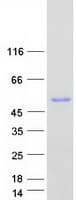 Human GART / GARS Protein (Recombinant Myc-DDK (Flag))