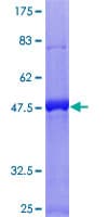 Human RGS16 Protein (Recombinant GST)