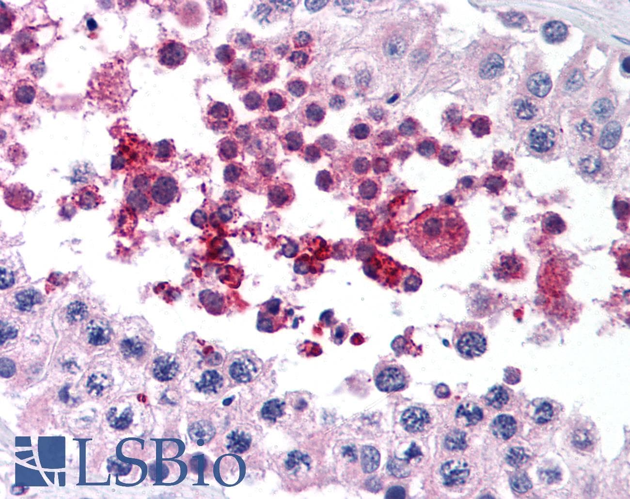 IHC-plus™ GPX4 / MCSP Antibody (aa81-93)