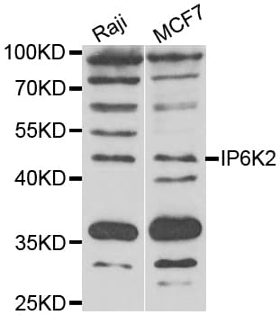 IP6K2 Antibody