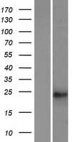 Human TUSC1 Protein (Over-Expression Lysate Myc-DDK (Flag))