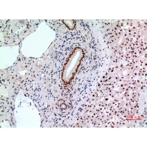 Polyclonal Rabbit anti-Human BCL6 Antibody (271-320 aa, Internal, IHC, WB)