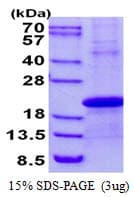 Human DPPA3 / STELLA Protein (Recombinant His)