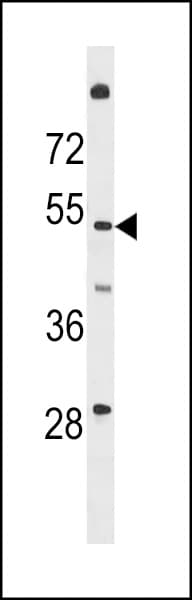 TMEM161A Antibody (aa34-63)