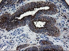Thymidylate Kinase Antibody (clone OTI1G8)