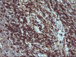 CD45 / LCA Antibody (clone OTI3F2)
