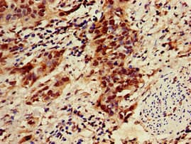 ZNF695 Antibody