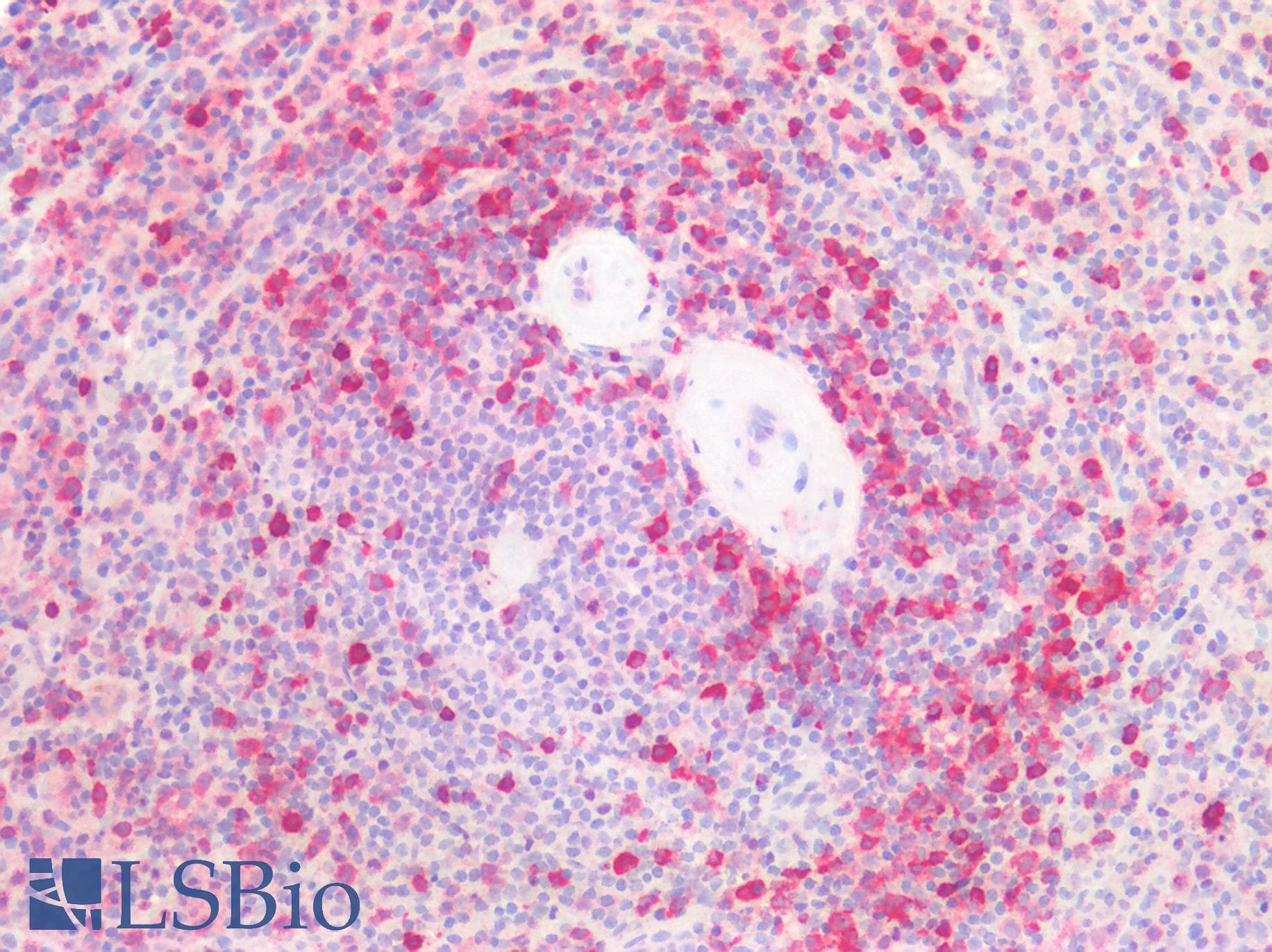 PathPlus™ STMN1 / Stathmin / LAG Antibody