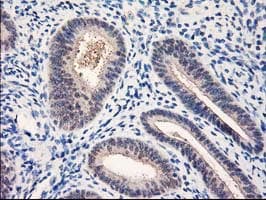 Monoclonal Mouse anti-Human NUBPL Antibody (clone OTI3D11, aa1-250, IHC, WB)