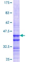 Human GNLY / Granulysin Protein (Recombinant GST, N-terminus)