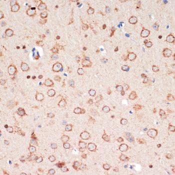 TH / Tyrosine Hydroxylase Antibody