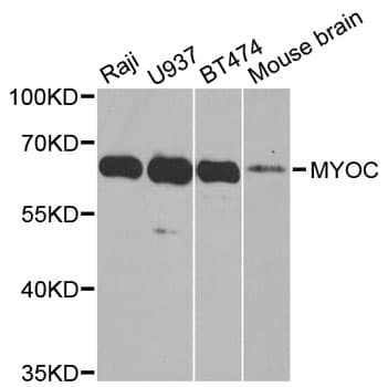 Polyclonal Rabbit anti-Human MYOC / Myocilin Antibody (IHC, WB)