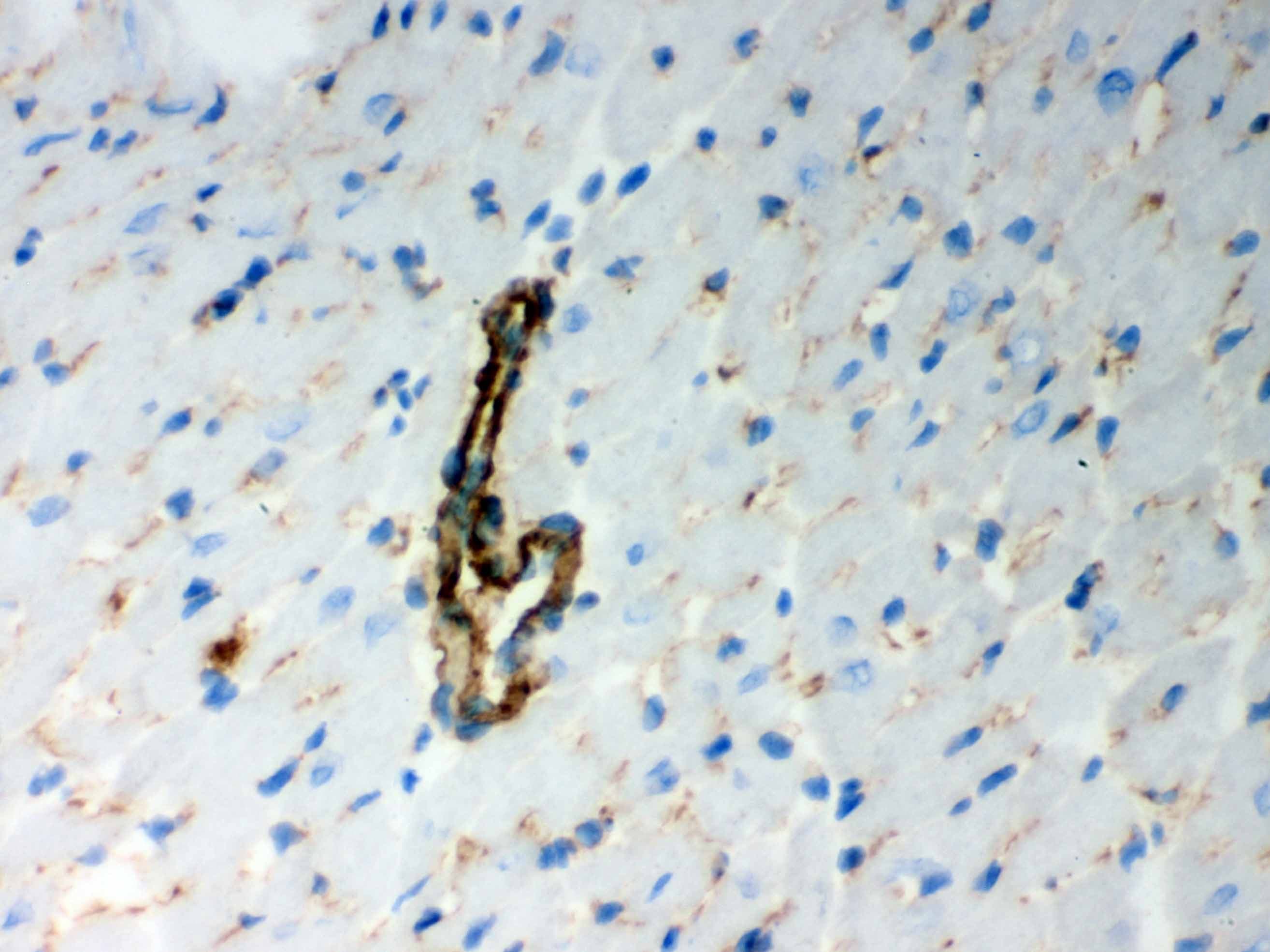 BAK1 / BAK Antibody (aa22-211)