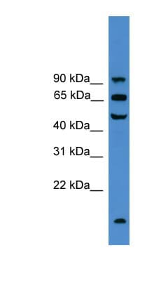 Polyclonal Rabbit anti-Human UMOD / Uromodulin Antibody (C-Terminus, WB)