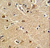 ZWINT Antibody (aa59-88)