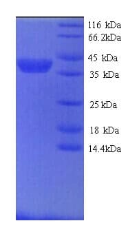 Dog MMP9 / Gelatinase B Protein (Recombinant His)