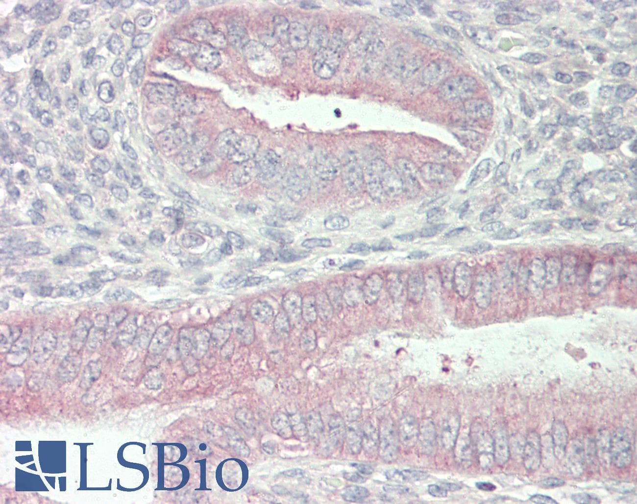 IHC-plus™ DCTN6 / Dynactin 6 Antibody (aa53-80)