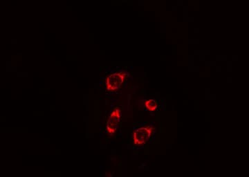 MRPL4 / MRP-L4 Antibody