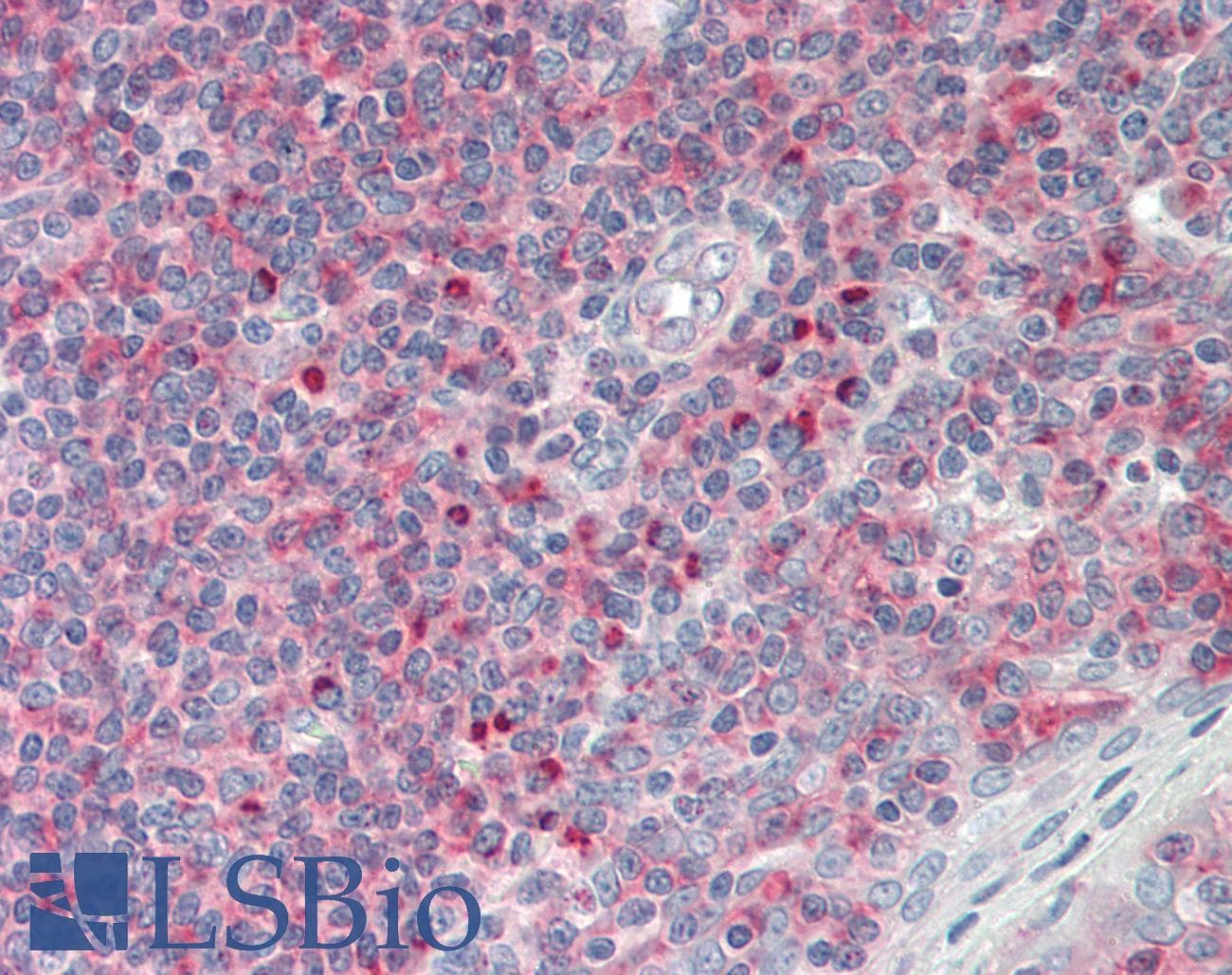 Polyclonal Rabbit anti-Mouse KDM6A / UTX Antibody (aa245-294, IHC, WB)