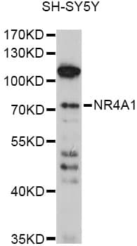 NR4A1 / NUR77 Antibody