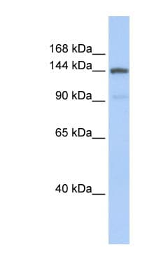 COL1A2 / Collagen I Alpha 2 Antibody (aa1044-1093)