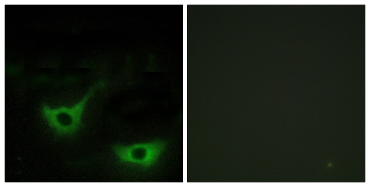 CALR / Calreticulin Antibody (aa21-70)